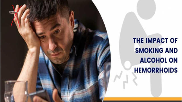 Thói quen hút thuốc lá làm tăng khả năng gây ra bệnh trĩ 