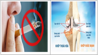 Thuốc lá - tác nhân gây bệnh viêm và thoái hóa xương khớp
