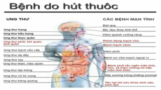 Thuốc lá – thủ phạm hàng đầu gây nên nhiều loại ung thư