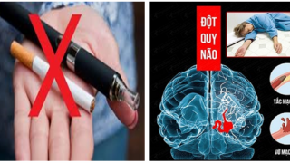 Nguy cơ đột quỵ cao do thói quen hút thốc lá